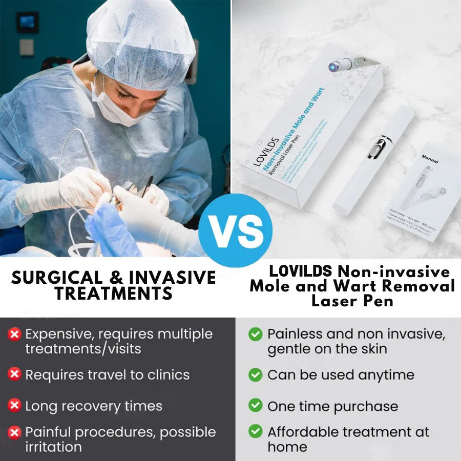 đĽăOFFICIAL STOREăLOVILDS⢠Non-Invasive Mole and Wart Removal Laser Pen