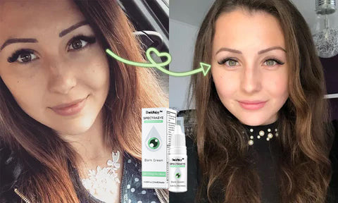 DarkFairy™ 𝑺𝒑𝒆𝒄𝒕𝒓𝒂𝑬𝒚𝒆 𝑪𝒐𝒍𝒐𝒓 𝑪𝒉𝒂𝒏𝒈𝒊𝒏𝒈 𝑫𝒓𝒐𝒑𝒔 𝑷𝒓𝒐 （👁️ Clinically Tested & Ophthalmologist Approved）🎁First 100 buyers enjoy 50% off