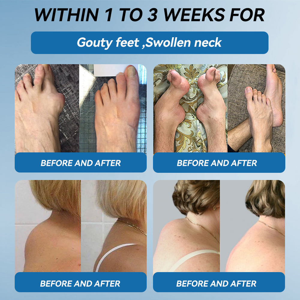 🇦🇺🫒LOVILDS™𝐁𝐏𝐂-𝟏𝟓𝟕 𝐉𝐨𝐢𝐧𝐭 𝐇𝐞𝐚𝐥𝐢𝐧𝐠 𝐂𝐫𝐞𝐚𝐦🦴Treats Arthritis, Neuropathy, Rheumatism, Sports Injuries & More🏆