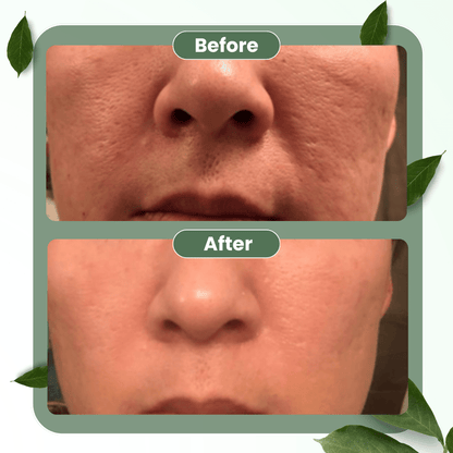 DarkFairy Green Tea Deep Cleanse Mask Stick ACE 1