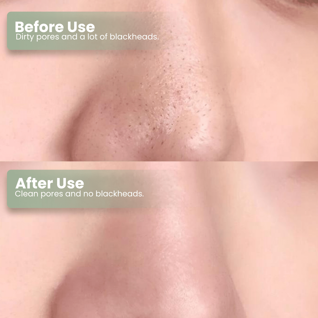 DarkFairy Green Tea Deep Cleanse Mask Stick ACE 1