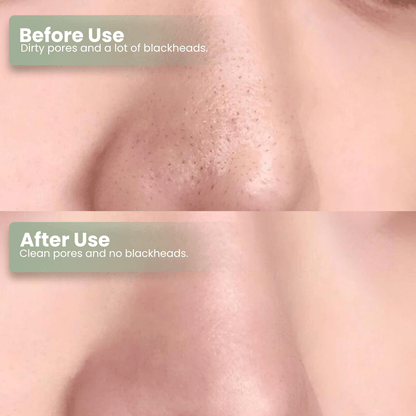 DarkFairy Green Tea Deep Cleanse Mask Stick ACE 1